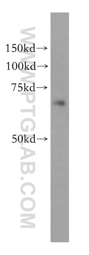 [15612-1-AP-150UL] KLHL13 Polyclonal antibody