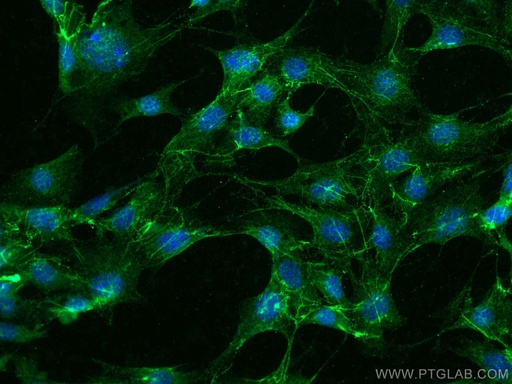 [15613-1-AP-150UL] Fibronectin Polyclonal antibody
