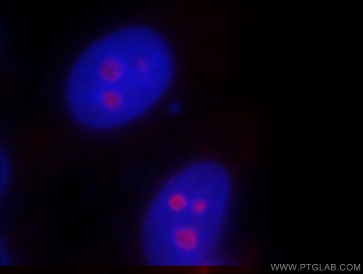 [15614-1-AP-20UL] SF4 Polyclonal antibody