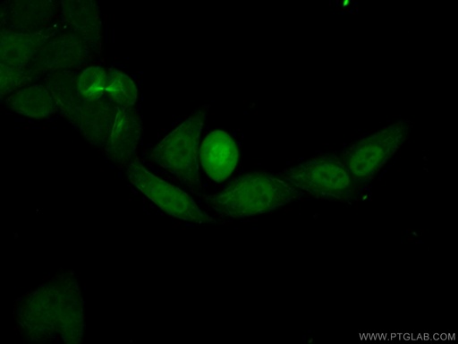 [15617-1-AP-20UL] PRC1 Polyclonal antibody