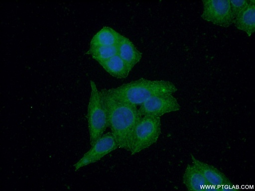 [15619-1-AP-150UL] CBR3 Polyclonal antibody