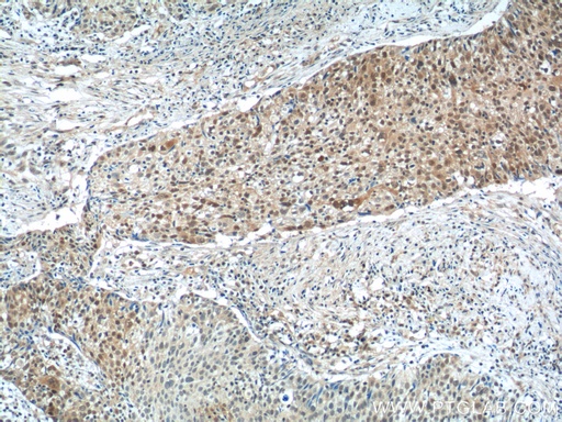 [15620-1-AP-150UL] NSFL1C Polyclonal antibody