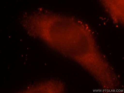 [15622-1-AP-150UL] ICA1L Polyclonal antibody