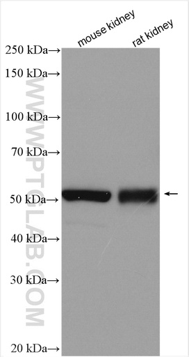 [15623-1-AP-20UL] GABRD Polyclonal antibody