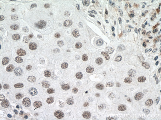 [15624-1-AP-150UL] U2AF65 Polyclonal antibody