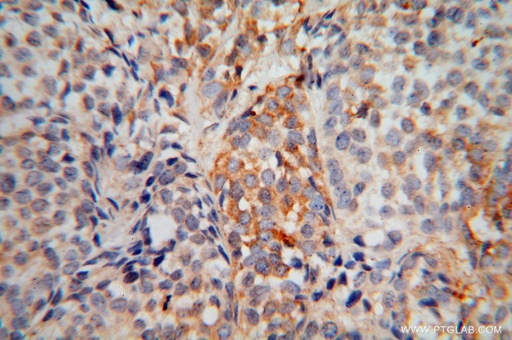 [15627-1-AP-20UL] EXOSC5 Polyclonal antibody