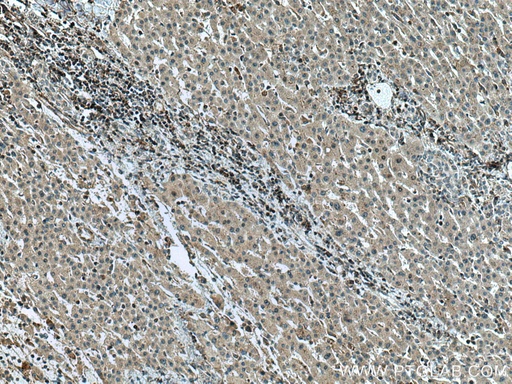 [15629-1-AP-20UL] GCK Polyclonal antibody
