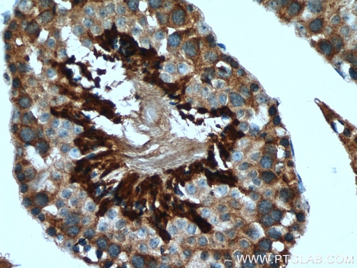 [15630-1-AP-150UL] NRD1 Polyclonal antibody