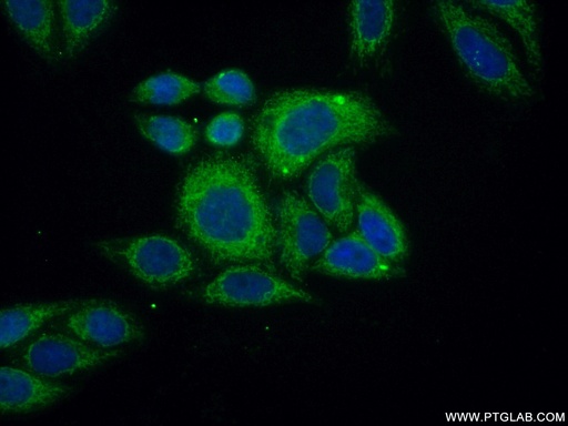 [15633-1-AP-150UL] ACOT2 Polyclonal antibody