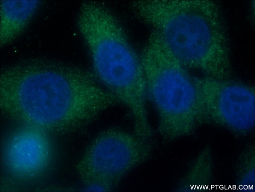 [15641-1-AP-150UL] SH2D3A Polyclonal antibody