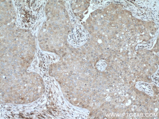 [15643-1-AP-20UL] DUS3L Polyclonal antibody