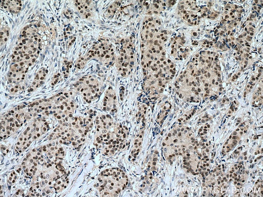 [15646-1-AP-20UL] POLD1 Polyclonal antibody