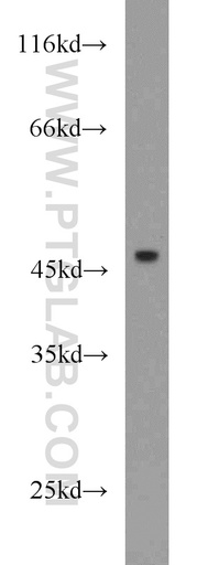 [15648-1-AP-150UL] IL-17RC Polyclonal antibody