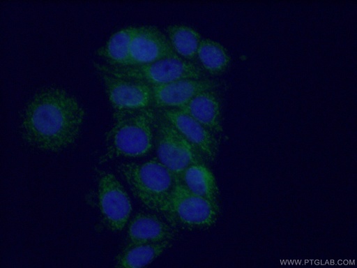 [15650-1-AP-150UL] MTO1 Polyclonal antibody
