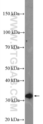 [15653-1-AP-150UL] VPS37B Polyclonal antibody