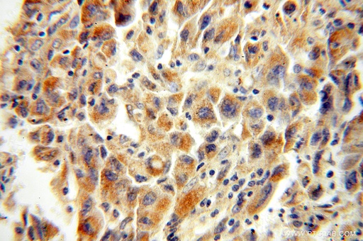 [15655-1-AP-150UL] XPNPEP3 Polyclonal antibody