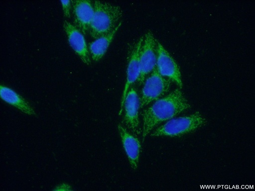 [15665-1-AP-20UL] ARHGAP9 Polyclonal antibody