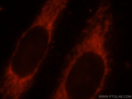 [15666-1-AP-20UL] SYNJ2BP Polyclonal antibody