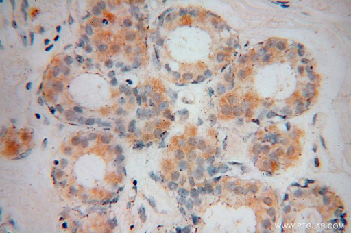 [15669-1-AP-20UL] VPS25 Polyclonal antibody