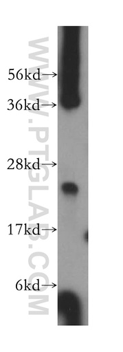 [15670-1-AP-150UL] ARD1B Polyclonal antibody