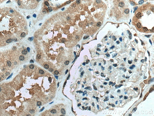 [15671-1-AP-20UL] PPIL3 Polyclonal antibody