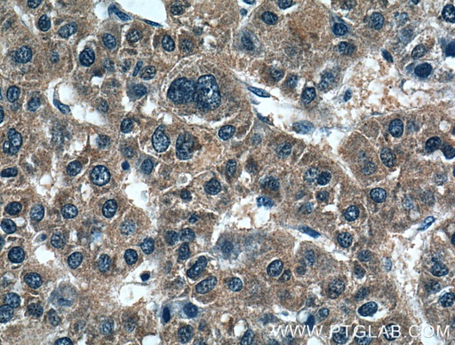 [15674-1-AP-20UL] PMVK Polyclonal antibody