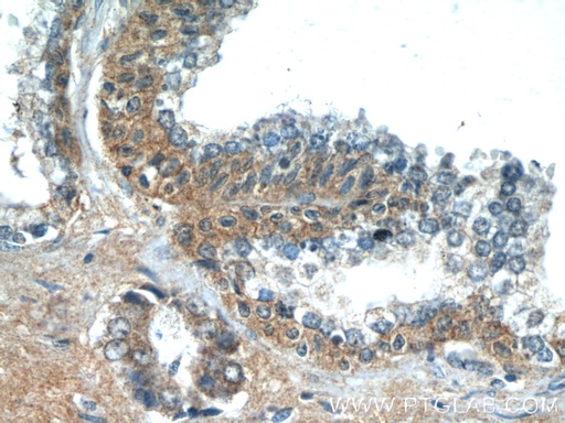 [15677-1-AP-20UL] LZTS2 Polyclonal antibody