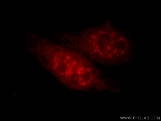 [15679-1-AP-150UL] HEYL Polyclonal antibody