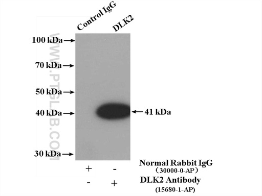 [15680-1-AP-150UL] DLK2 Polyclonal antibody