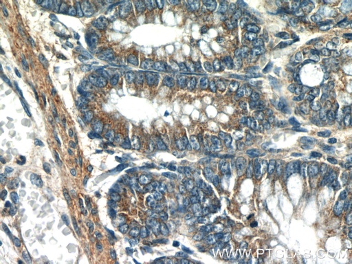 [15685-1-AP-20UL] UBE2H Polyclonal antibody