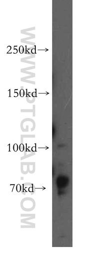 [15687-1-AP-150UL] DLG5 Polyclonal antibody