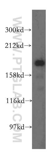 [15688-1-AP-150UL] ERCC6L Polyclonal antibody
