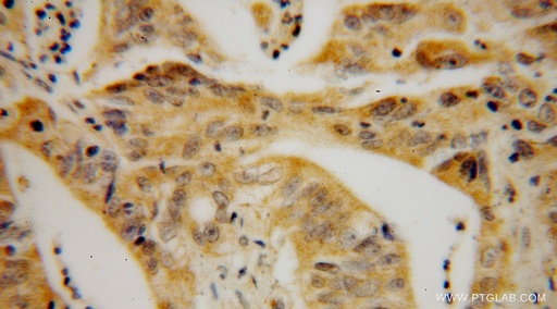 [15689-1-AP-150UL] STARD7 Polyclonal antibody