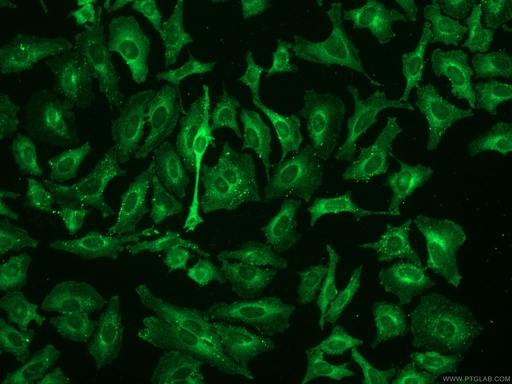 [15690-1-AP-150UL] AP2B1 Polyclonal antibody