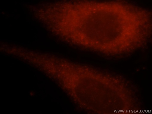 [15691-1-AP-150UL] TK1 Polyclonal antibody