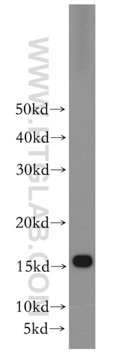 [15692-1-AP-150UL] RPS20 Polyclonal antibody