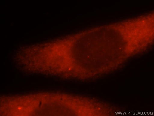 [15693-1-AP-150UL] ATXN10 Polyclonal antibody