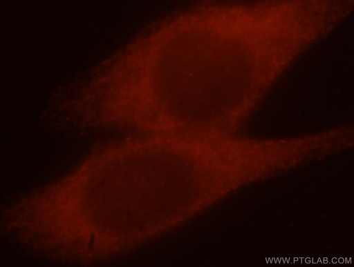 [15695-1-AP-20UL] MAP1S Polyclonal antibody