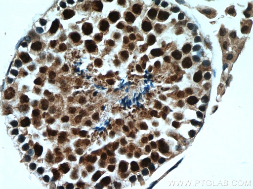 [15697-1-AP-20UL] PRM1 Polyclonal antibody