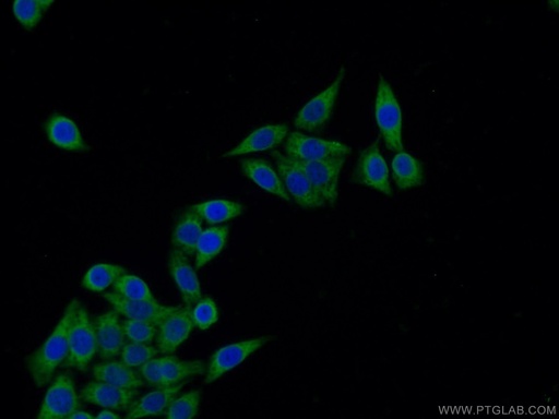 [15699-1-AP-150UL] IGFBP2 Polyclonal antibody