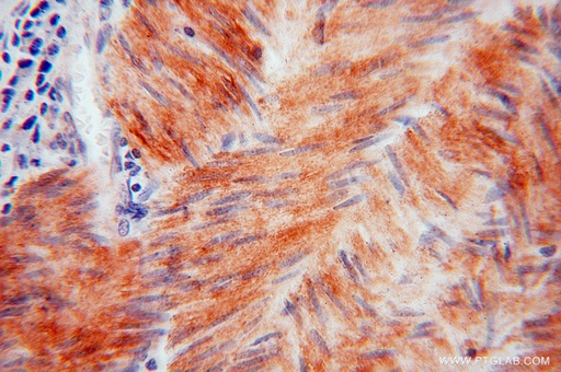 [15700-1-AP-20UL] HSPB7 Polyclonal antibody