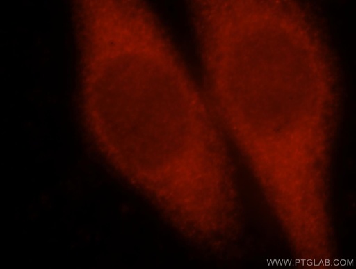 [15702-1-AP-20UL] PCBD1 Polyclonal antibody