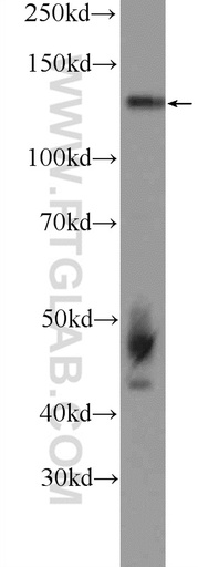 [15706-1-AP-150UL] NOL6 Polyclonal antibody
