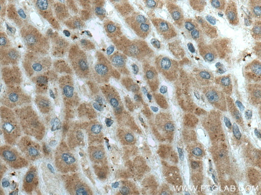 [15707-1-AP-20UL] L2HGDH Polyclonal antibody