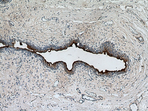 [15709-1-AP-150UL] UPK3B Polyclonal antibody