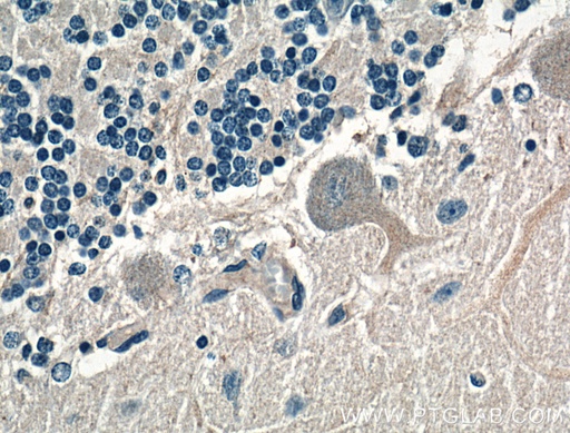[15710-1-AP-20UL] AMPD2 Polyclonal antibody