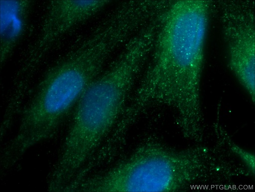 [15712-1-AP-20UL] GSS Polyclonal antibody