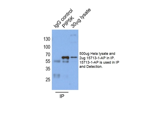 [15713-1-AP-20UL] PIP5K1A Polyclonal antibody