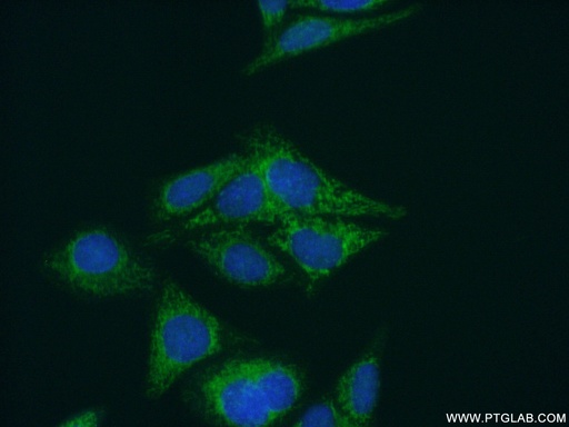 [15714-1-AP-150UL] NARS2 Polyclonal antibody