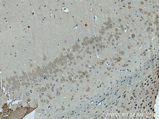 [15716-1-AP-20UL] RIMBP2 Polyclonal antibody